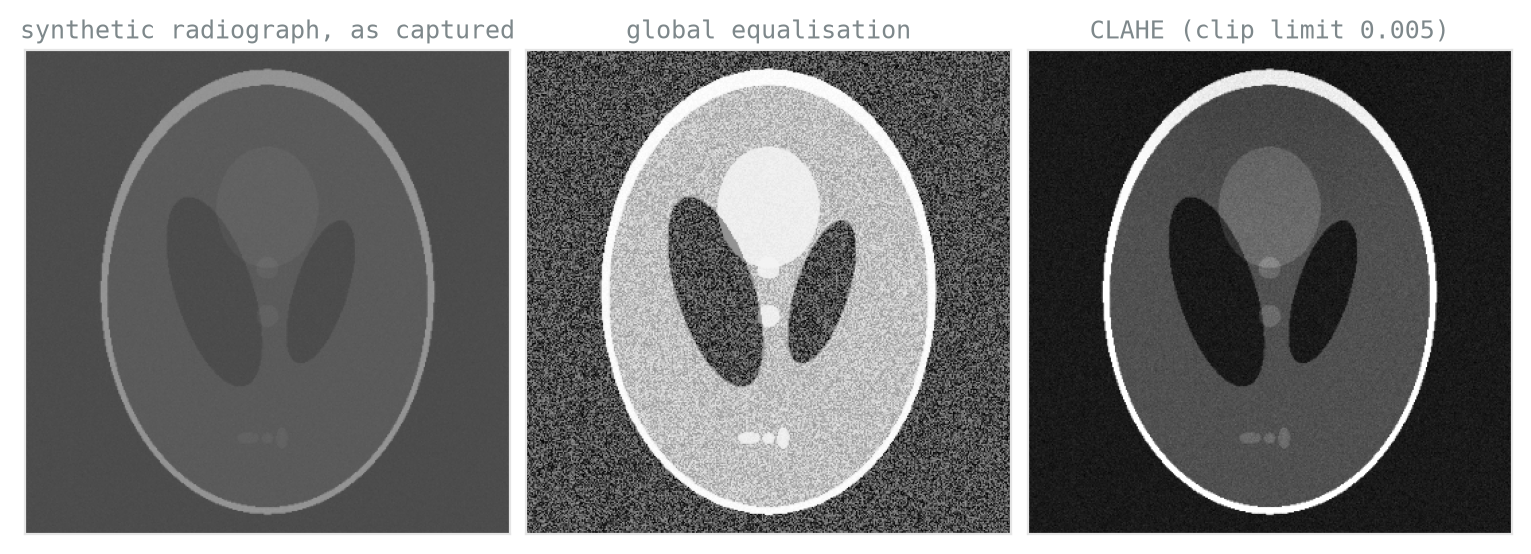 Three grayscale panels. Left: a dim, low-contrast oval phantom resembling a cross-section radiograph, smooth and nearly featureless. Middle: the same image after global histogram equalisation, with the internal ellipses now clearly visible but the background and uniform interior covered in salt-and-pepper mottle. Right: the CLAHE version, with the same anatomy visible and only faint residual grain.
